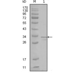 Fyn Related Kinase (FRK) Antibody