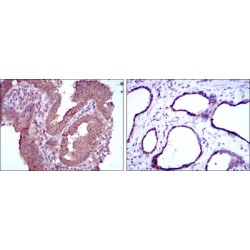 Methylenetetrahydrofolate Reductase (MTHFR) Antibody