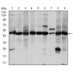 Argininosuccinate Synthase (ASS1) Antibody