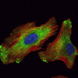 Wnt Inhibitory Factor 1 (WIF1) Antibody