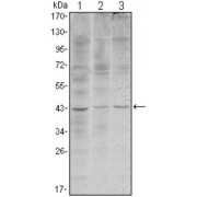 Western blot analysis using WIF1 antibody against Hela (1), NIH/3T3 (2) and NTERA-2 (3) cell lysate.