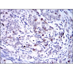 KID Antibody