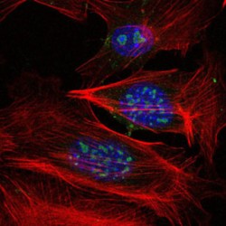Mitogen-Activated Protein Kinase Kinase Kinase 2 (MAP3K2) Antibody