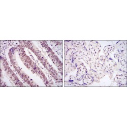 Cyclin-Dependent Kinase 9 (CDK9) Antibody