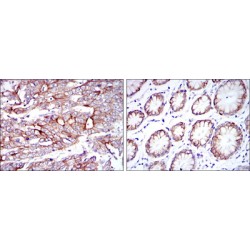 Keratin 19 (KRT19) Antibody