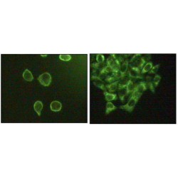 Mitogen-Activated Protein Kinase 10 / JNK3 (MAPK10) Antibody