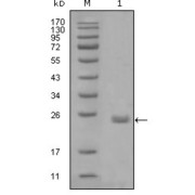 Western blot analysis using AXL antibody against truncated Trx-AXL recombinant protein (1).