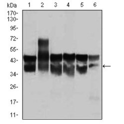 Cyclin-Dependent Kinase 2 (CDK2) Antibody