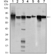 Western blot analysis using STAT5B antibody against Hela (1), K562 (2), NIH/3T3 (3), C6 (4), HEK293 (5), Jurkat (6) and HL-60 (7) cell lysate.