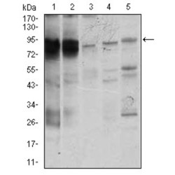 Signal Transducer And Activator of Transcription 5A (STAT5A) Antibody