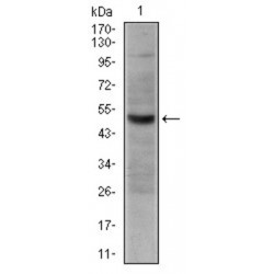 Tumor Necrosis Factor Receptor Superfamily Member 8 / CD30 (TNFRSF8) Antibody