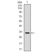 Western blot analysis using CD30 antibody against human CD30 (AA: 536-590) recombinant protein. (Expected MW is 32 kDa).