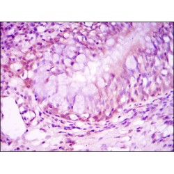 Nuclear Receptor Subfamily 3, Group C, Member 1 (Glucocorticoid Receptor) (NR3C1) Antibody