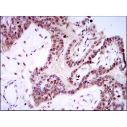 Transcription Factor Spi-B (SPIB) Antibody
