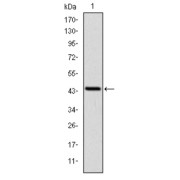 Western blot analysis using PINCH antibody against human PINCH (AA: 87-249) recombinant protein. (Expected MW is 44.2 kDa).