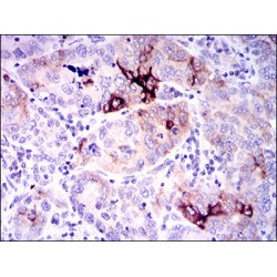 Osteopontin (SPP1) Antibody