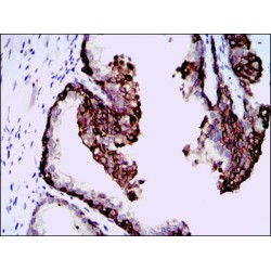 Hyaluronan Synthase 3 (HAS3) Antibody