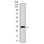 Western blot analysis using HAS3 antibody against human HAS3 (AA: 312-364) recombinant protein. (Expected MW is 32 kDa).