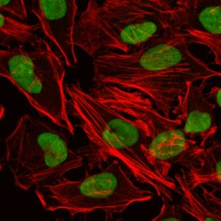 X-Ray Repair Cross Complementing 5 (XRCC5) Antibody