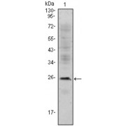 Western blot analysis using CD3E antibody against Jurkat (1) cell lysate.