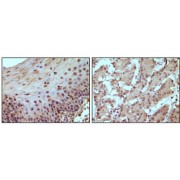 Immunohistochemical staining of paraffin-embedded human normal esophagus (A) and stomach (B) tissue, showing nucleus localization using Rb antibody with DAB staining.