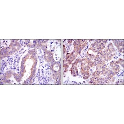 Proto-Oncogene C-Rel (c-Rel) Antibody