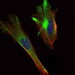 CREB-Regulated Transcription Coactivator 2 (CRTC2) Antibody