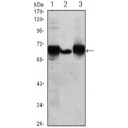 Western blot analysis using ALPP antibody against HepG2 (1), A431 (2) and MCF-7 (3) cell lysate.