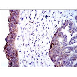 Alkaline Phosphatase, Tissue-Nonspecific Isozyme (ALPL) Antibody