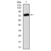 Western blot analysis using ALPL antibody against human ALPL (AA: 18-502) recombinant protein. (Expected MW is 78.9 kDa).