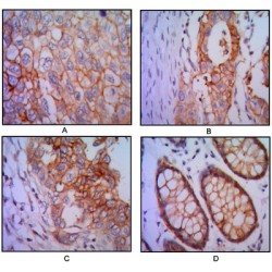 Epithelial Cell Adhesion Molecule (EPCAM) Antibody