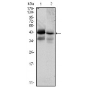 Western blot analysis using EPCAM antibody against HTC116 (1) and T47D (2) cell lysate.