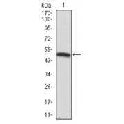 Western blot analysis using FOXP1 antibody against human FOXP1 recombinant protein. (Expected MW is 47.7 kDa).