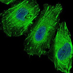Forkhead Box Protein O1 (FOXO1) Antibody