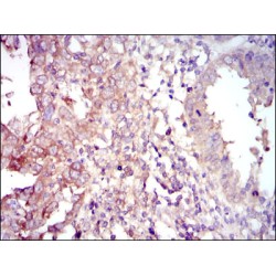 Forkhead Box Protein O1 (FOXO1) Antibody