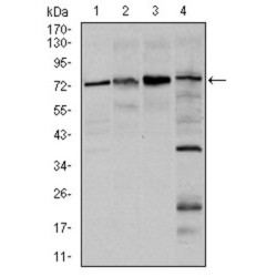 Forkhead Box Protein O1 (FOXO1) Antibody