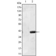 Western blot analysis using MATN1 antibody against HEK293 (1) and MATN1 (AA: 427-496) -hIgGFc transfected HEK293 (2) cell lysate.