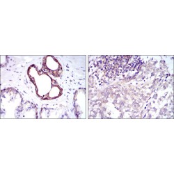 Nuclear Factor NF-Kappa-B P105 Subunit (NFKB1) Antibody