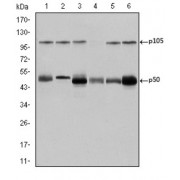 Western blot analysis using NFKB1 antibody against K562 (1), Jurkat (2), A431 (3), Hela (4), THP-1 (5) and MCF-7 (6) cell lysate.