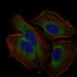 CD59 Glycoprotein (CD59) Antibody