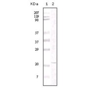 Western blot analysis using FAK antibody against truncated FAK recombinant protein.