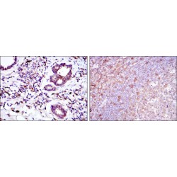 BH3-Interacting Domain Death Agonist (BID) Antibody