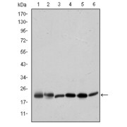 abx011976