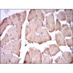 Troponin I, Fast Skeletal Muscle (TNNI2) Antibody