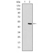 Western blot analysis using TNNI2 antibody against human TNNI2 (AA: 1-182) recombinant protein. (Expected MW is 46.8 kDa).