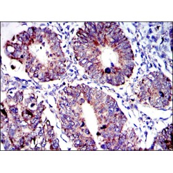 Apoptosis Inducing Factor (AIF) Antibody