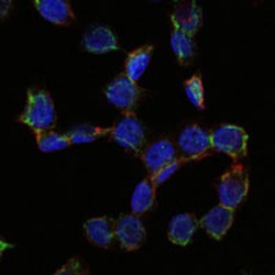 Endoglin / CD105 (ENG) Antibody