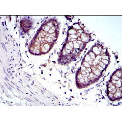 Junction Plakoglobin (JUP) Antibody