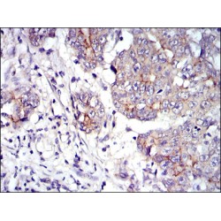 Junction Plakoglobin (JUP) Antibody