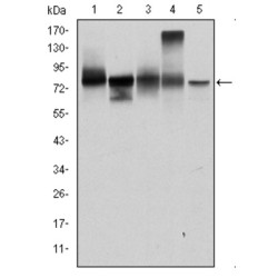 Junction Plakoglobin (JUP) Antibody